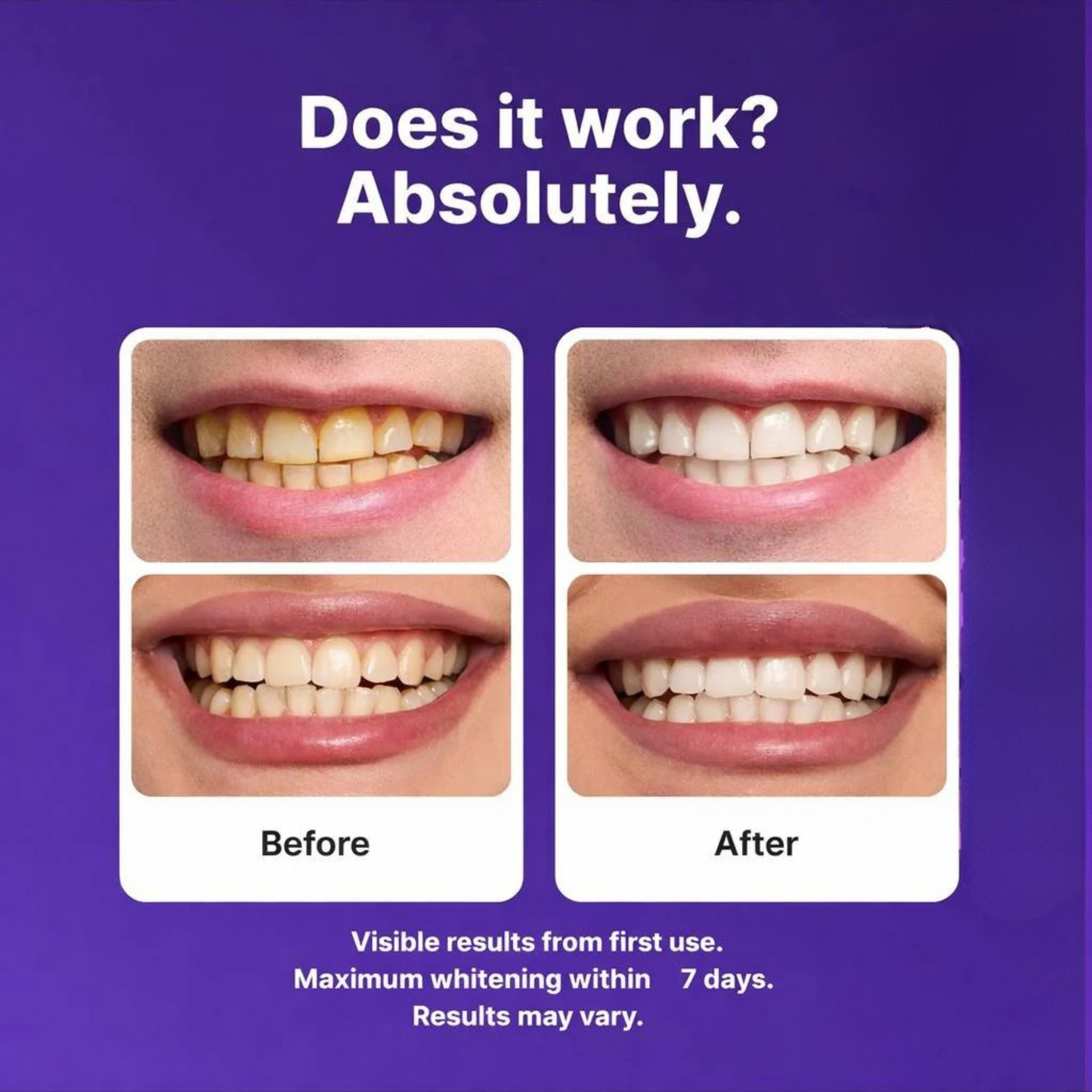 zentro Purple Teeth Whitening Strips™